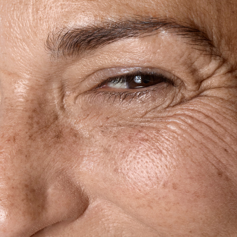 Wrinkles, Fine Lines, Sagging Skin